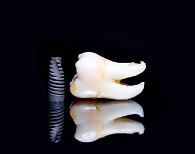 Zygomatic implants