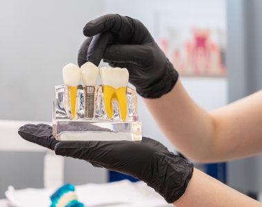 What to Expect from a Dental Implant