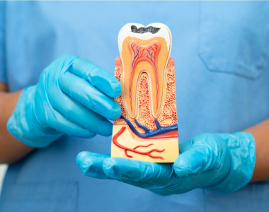Root Canals: Myths vs. Facts